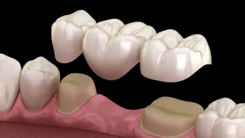 Siri Dental Care, KM Naganna road, Cubbonpet main road at 13 cross — Dental clinic on SP Road, Bangalore